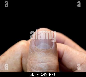 Grands lunulae ou demi-lune à l'ongle avec des lignes verticales de l'asiatique du Sud-est, vieux chinois. Banque D'Images