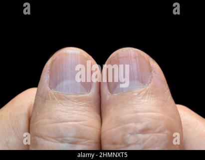 Grands lunulae ou demi-lune à l'ongle avec des lignes verticales de l'asiatique du Sud-est, vieux chinois. Banque D'Images