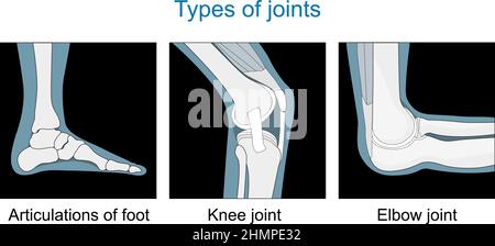 Types de joints. Articulation du genou, articulations du pied, articulation du coude. Définir les icônes. Noir et blanc. Illustration vectorielle plate. Illustration de Vecteur