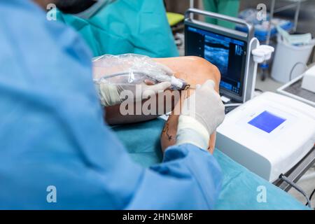 Processus de chirurgie de la veine variqueuse dans l'hôpital, salle d'opération, scellement de la veine, chirurgie vasculaire veineuse concept Banque D'Images