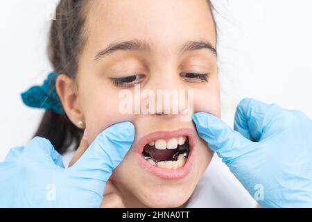 Le dentiste vérifie et définit la dimension des supports. Parler à une fille d'accolades dans sa bouche Banque D'Images