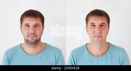 Collage d'un homme avant et après le rasage. Son visage n'est pas rasé et sans barbe. Banque D'Images