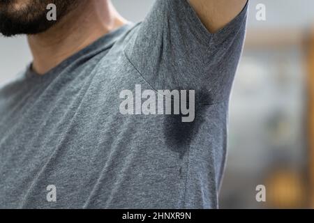 L'homme avec l'hyperhidrose la transpiration très mal sous aisselle Banque D'Images