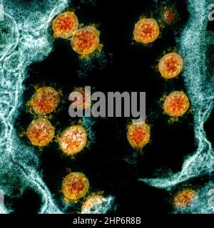 Micrographe électronique de transmission des particules du virus du SRAS-COV-2 (orange), isolées d'un patient ca. 2020 Banque D'Images