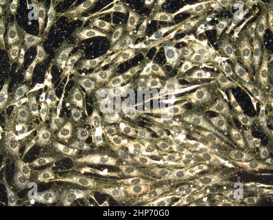 Les nanoparticules d'or ont de nombreuses propriétés qui les rendent passionnants objets d'étude dans la recherche sur le cancer. Par exemple, ils sont non toxiques, peuvent transporter une variété d'agents thérapeutiques et diagnostiques, et sont assez petits pour atteindre des cibles dans le corps que les autres systèmes d'administration ne peuvent pas. Cette image de champ sombre montre la livraison de nanoparticules d'or (points jaunes) dans le cytosol des cellules. CA. 2008 Banque D'Images