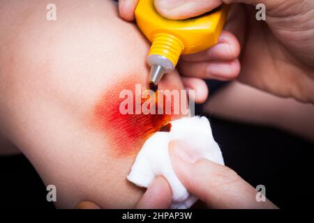 L'infirmière fournit les premiers soins en cas d'ecchymose et de blessure sur la jambe de l'enfant. Prise de vue en studio Banque D'Images