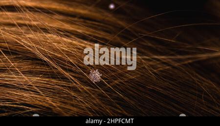Flocons de neige dans les cheveux. Cheveux et neige Banque D'Images