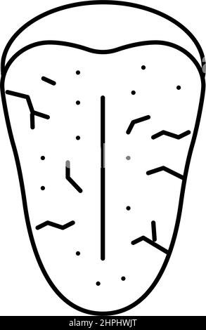 illustration du vecteur de la ligne du syndrome de sjogrens Illustration de Vecteur