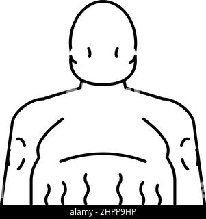 illustration vectorielle de la ligne d'endocrinologie de la maladie de cushing Illustration de Vecteur