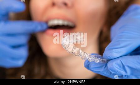 Orthodontiste médecin en gants en silicone invisible bretelles transparentes sur les dents de la femme dans la clinique de dentiste, vue rapprochée de la bouche. Correction des dents t Banque D'Images