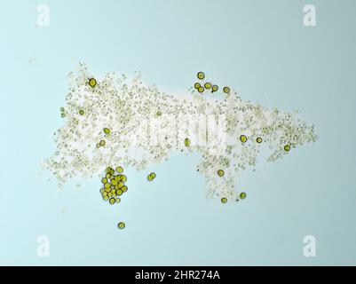 Algues de soucoupe de drainage de pot de fleur sous le microscope Banque D'Images
