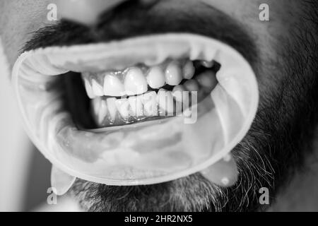 Jeune homme choisissant la couleur des dents chez le dentiste. Dentiste femme vérifiant les dents du patient avec miroir dans la clinique dentaire moderne. Portrait de gai masculin Banque D'Images