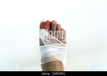 Les jambes d'un homme avec du sang bandé gros orteil isolé sur fond blanc Banque D'Images