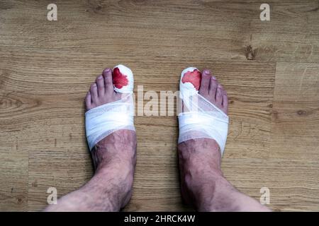 Les jambes d'un homme avec du sang bandé les gros orteils debout sur le sol Banque D'Images