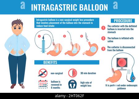 Ballon gastrique, illustration conceptuelle Banque D'Images