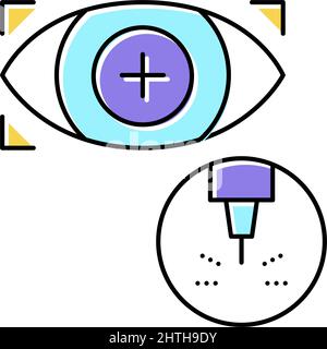 illustration du vecteur de couleur du traitement laser de la vision oculaire Illustration de Vecteur