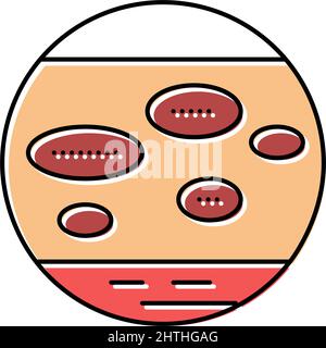 illustration du vecteur de couleur de l'eczéma numulaire Illustration de Vecteur