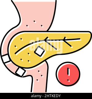illustration vectorielle d'icône de couleur de pierres dans le pancréas Illustration de Vecteur