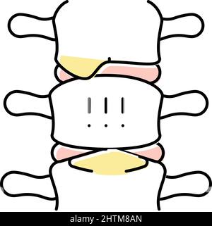 illustration vectorielle de l'icône de couleur de la spondylarthrite ankylosante Illustration de Vecteur