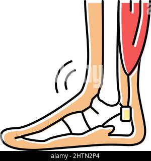 illustration vectorielle de l'icône de couleur du problème de tendonitis Illustration de Vecteur