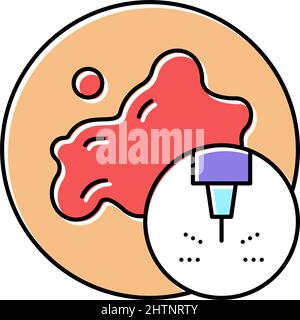 illustration vectorielle de l'icône de couleur laser de resurfaçage Illustration de Vecteur