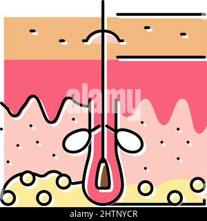 illustration vectorielle d'icône de couleur de production de peau de sébum Illustration de Vecteur