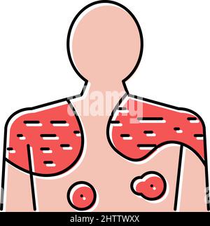 illustration du vecteur de couleur de l'icône de la maladie du psoriasis Illustration de Vecteur