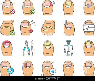 Vecteur de jeu d'icônes de la collection de la maladie à ongles incarné . Illustration de Vecteur