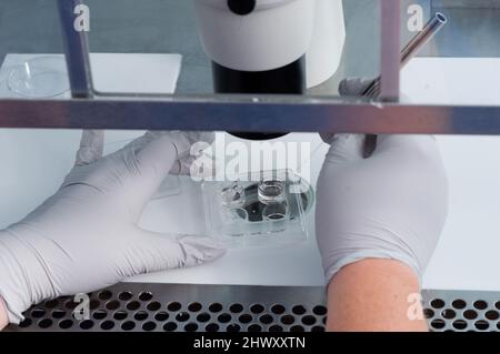 Un assistant de laboratoire vérifie les échantillons prélevés sur une patiente pendant l'opération pour vérifier la présence d'œufs. De tous les échantillons prélevés, en moyenne, environ dix ou ele Banque D'Images