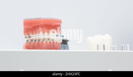 Entretoises en métal et en céramique sur les dents sur une mâchoire artificielle de près. Accolades sur les dents artificielles gros plan, dentisterie dentaire. Modèle de mâchoire pour l'affichage d'un Banque D'Images