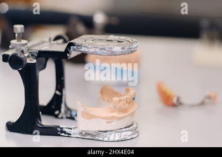 Modèle de dents en plâtre de la mâchoire pour les techniciens dentaires. Banque D'Images