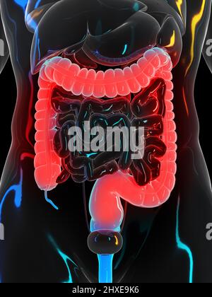 Côlon douloureux, illustration Banque D'Images