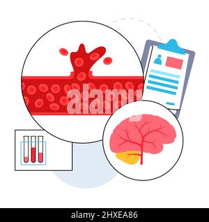 Recherche sur les accidents vasculaires cérébraux hémorragiques, illustration Banque D'Images