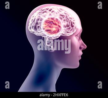 La femme et le cerveau humain vus en profil. Rayons X. Maladie dégénérative, synapses et neurones, fonctionnement du cerveau. Accident vasculaire cérébral et problèmes cognitifs. Parkinson Banque D'Images