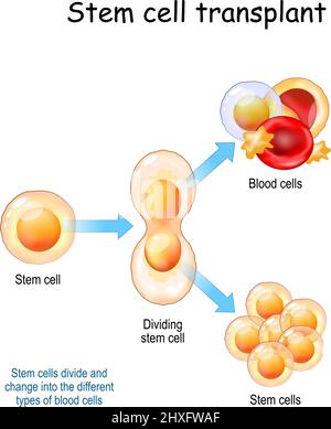 Greffe de cellules souches. Les cellules souches se divisent et se changent en différents types de cellules sanguines. Illustration vectorielle Illustration de Vecteur