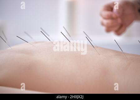 main du médecin professionnel effectuant l'acupuncture pour la femme cliente. femme subissant un traitement d'acupuncture avec une ligne d'aiguilles fines inser Banque D'Images