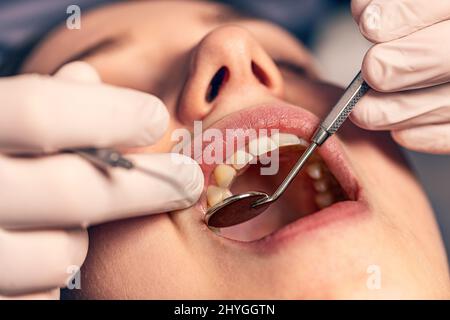 Gros plan de la jeune femme ayant ses dents examinées Banque D'Images