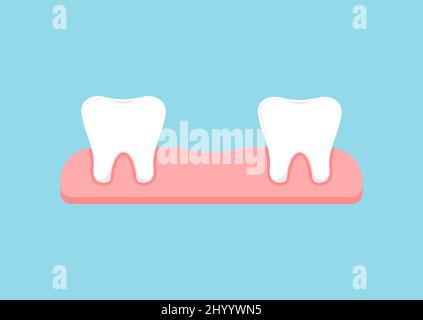 Perte de dents de bébé dans l'icône de gym isolée Illustration de Vecteur