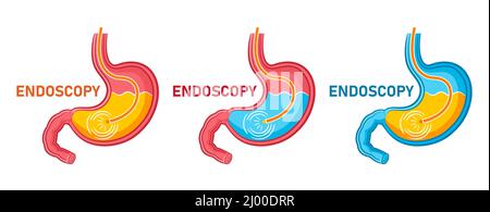 Endoscopie estomac, icône de gastroscopie. Endoscope de gastroentérologie, examen médical tube digestif, gastrite de traitement, ulcère interne vecteur d'organe Illustration de Vecteur