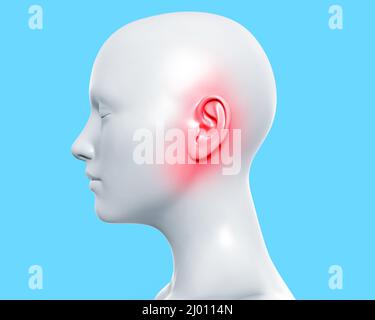 3d effectuez le rendu de l'illustration de la figure femelle de couleur grise avec inflammation de l'oreille sur fond bleu. Banque D'Images