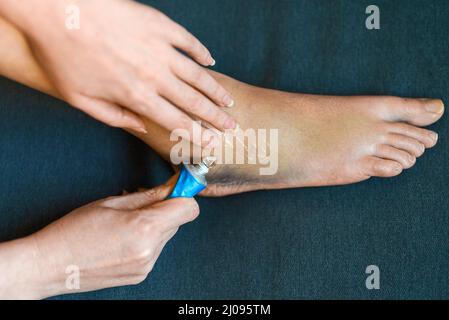 La femme applique du gel à sa jambe blessée. Banque D'Images