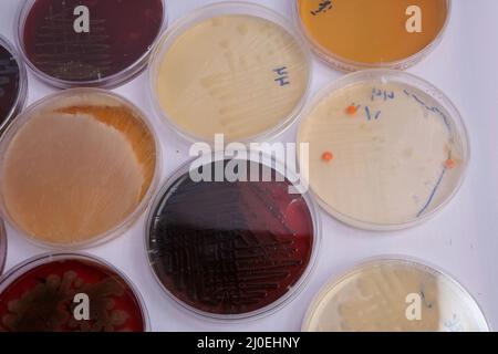 la collecte de plaques de culture contient la croissance de micro-organismes sur différents milieux de culture Banque D'Images