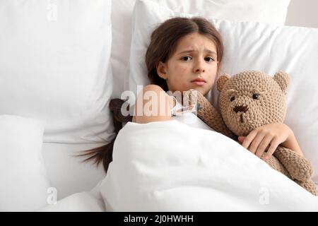 Petite fille malade avec la varicelle au lit Banque D'Images