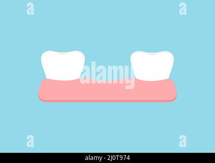 Perte de dents de bébé dans l'icône de gym isolée. Illustration de Vecteur