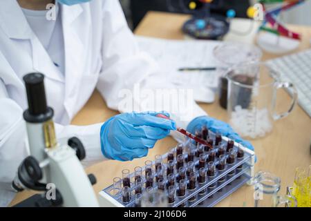 La main d'un médecin prélève un tube d'échantillon de sang sur le plateau de l'analyseur. Banque D'Images