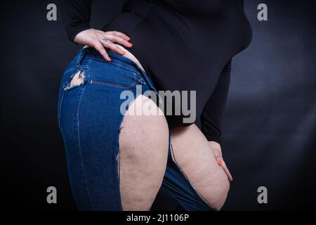 femme grasse en jeans déchirés sur fond noir Banque D'Images