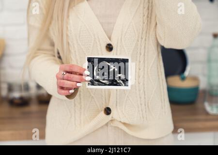 Blonde enceinte caucasienne femme en vêtements légers montrant le dépistage d'ultrasons prénatal à la caméra sélective foyer . Photo de haute qualité Banque D'Images