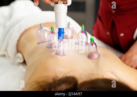 Jeune femme subissant un massage avec des banques de vide sur son dos dans le salon de spa, concept de traitement de banques de vide. Banque D'Images