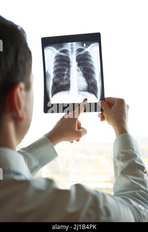 Homme en chemise tient la fluorgraphie dans la lumière. Le médecin montre le problème. Banque D'Images