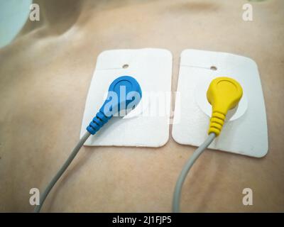Enregistrement ECG sur 24 heures. Surveillance Holter. Capteurs Holter bleus et jaunes - cœur avec Ukraine. Photo horizontale. Banque D'Images